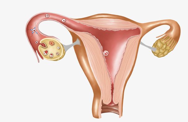 卵巢癌的症状有哪些？
